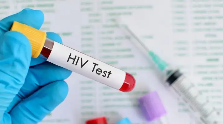 Varanasi HIV Cases: नौ माह में 300 से ज्यादा मिले एचआईवी पाॅजीटिव, युवाओं में तेजी से फैल रहा संक्रमण