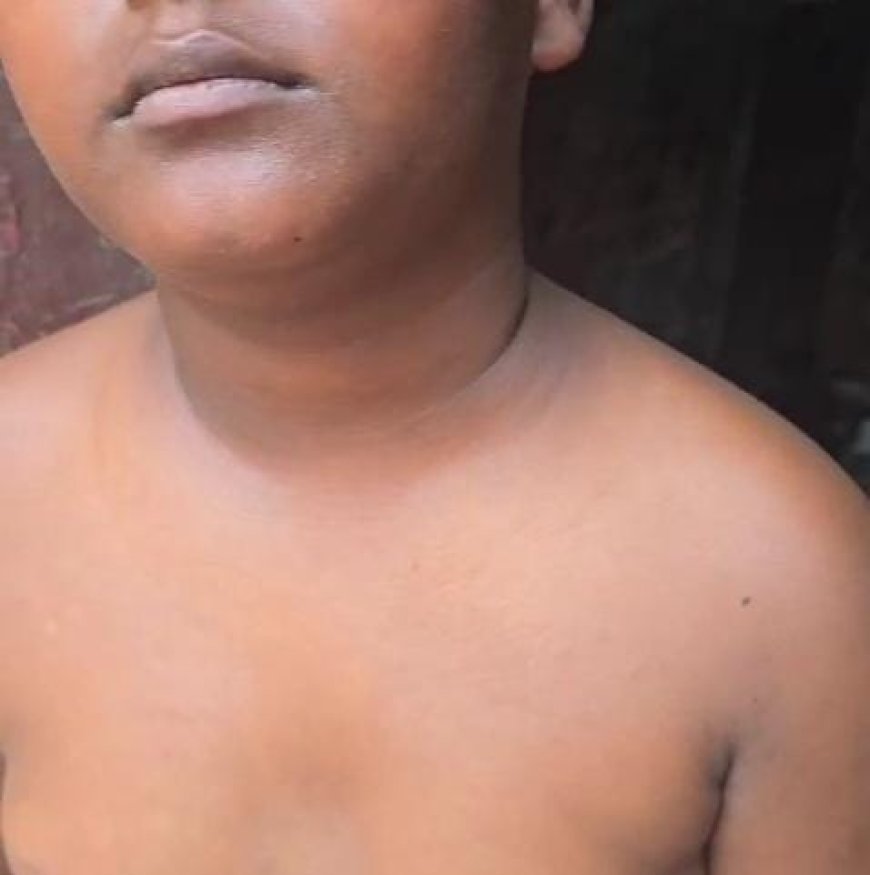 बाराबंकी: चोरी के आरोप में नाबालिग को तालिबानी सजा, बिजली के झटके देने का आरोप